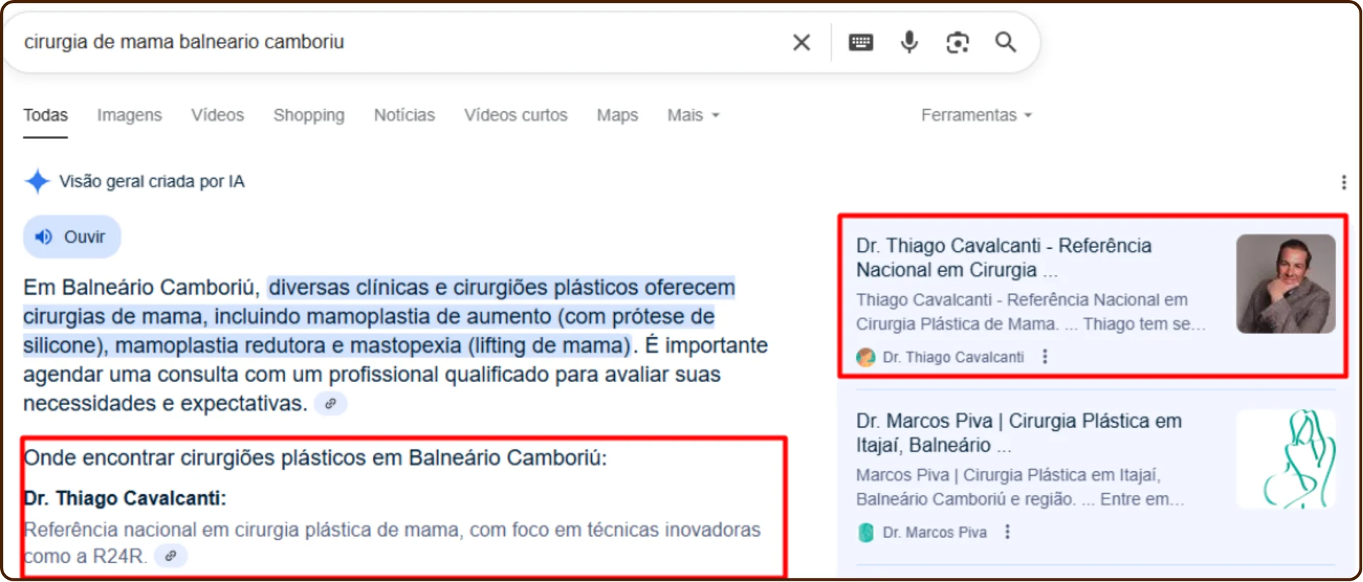 Captura da visão geral por IA do Google mencionando Dr. Thiago Cavalcanti na busca por cirurgia de mama em Balneário Camboriú e exibindo seu site como fonte